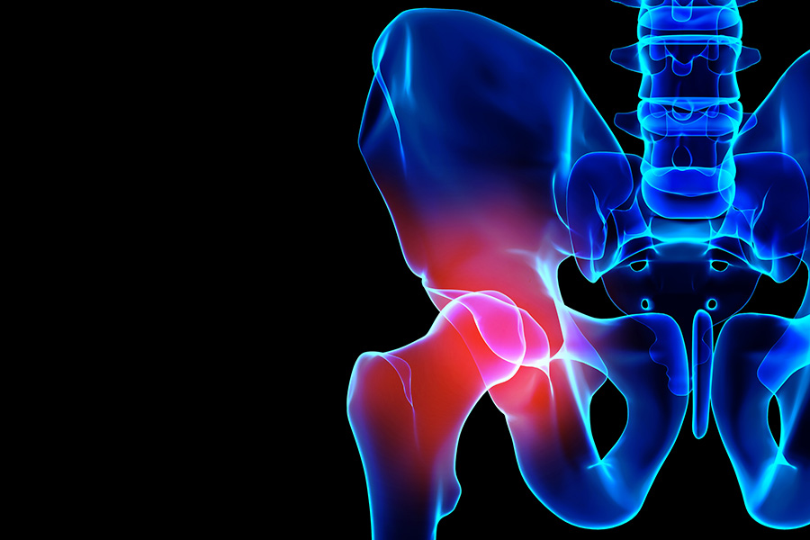 Hip painful skeleton x-ray, 3D illustration.